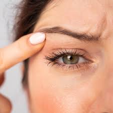SkinTyte to Eyelids