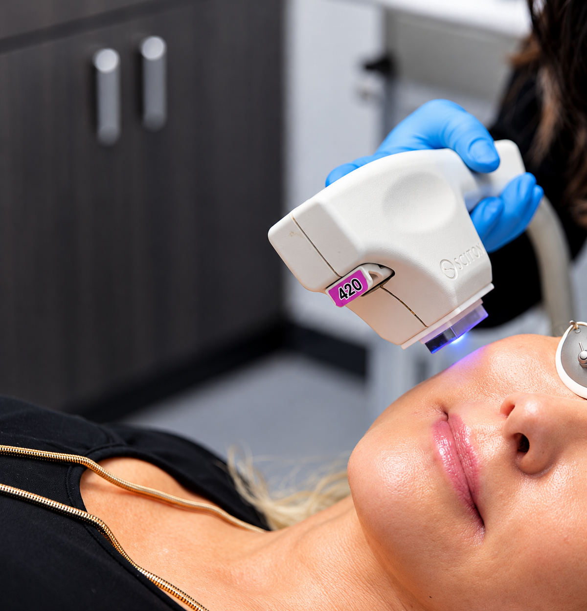 BBL Forever Clear™ Treatment (Full Face)