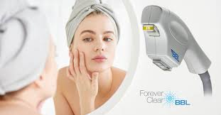 BBL Forever Clear Acne Treatment Full Face